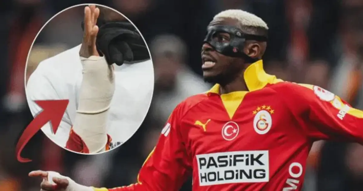 ഗലതസറെ താരം വിക്ടർ ഒസിമെൻ അണിഞ്ഞ പ്രൊട്ടക്റ്റീവ് കാസ്റ്റിനെതിരെ തുർക്കിഷ് ഫെഡറേഷനിൽ പരാതി നൽകി ഫെനർബാച്ചെ